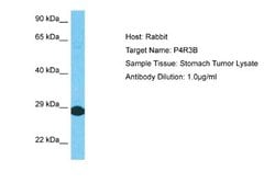 SMEK2 Antibody, Novus Biologicals 100 &mu;L | Buy Online | Novus Biologicals | Fisher Scientific
